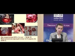 Экстракорпоральные методы детоксикации в онкологии