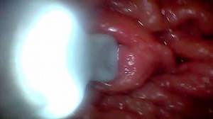 First time&colon; An endoscope reveals the G-spot up close – without mounting&excl;