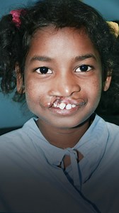 431K views · 2.8K reactions | Every child deserves to be seen for what they have inside, not just their cleft condition. | Operation Smile | Facebook