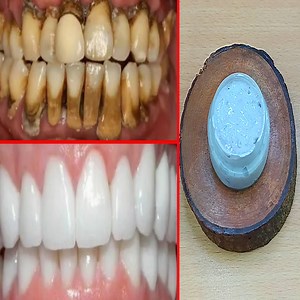 64K views · 755 reactions | Homemade natural teeth whitening toothpaste recipe #teethwhitening | Simple Home Remedies | Facebook