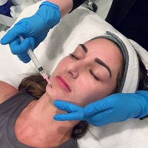 PRX-T33 is a liquid that, applied with a specific technique, provides immediate aesthetic improvement and deep hydration. • ✅ 33% TCA Hydrogen Peroxide with NO Peeling ✅ Stimulates the Skin’s Regenerative Process ✅ No Downtime. No Pain. No Needles. No Surgery ✅ Safe for All Skin Types: Fitzpatrick 1-6 ✅ Targets Aging Skin, Texture, Laxity, Wrinkles, & Dull Skin ✅ Non-Photosensitizing: Can be used in Summer Months • Call us at 225.399.0001 to schedule your PRX-T33 treatment today! | Weiler Plasti