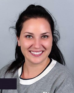 Diastema Treatment at CLDC