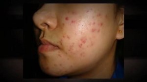 5 Most #Common #Skin #Disorders | Medical & Health Talk | Facebook