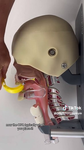 Understanding OPA and NPA in Paramedic Training