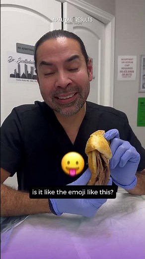 Labiaplasty Explained