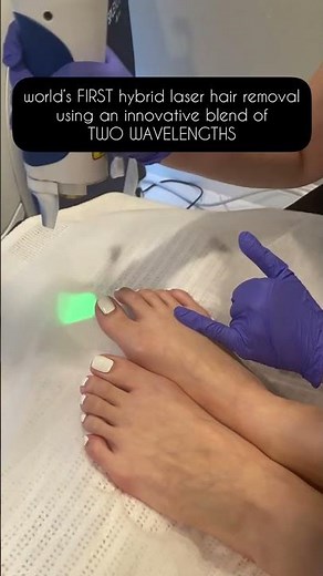 Splendor X Laser Hair Removal【BHPS】