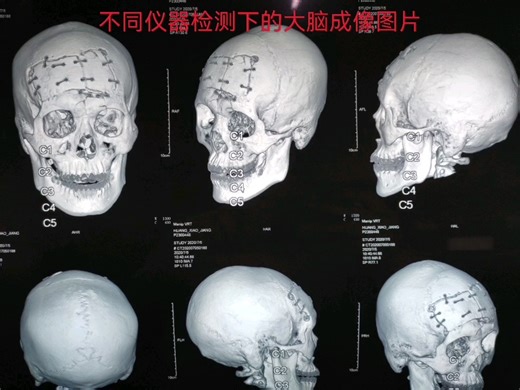 不同检测方法下的大脑成像图