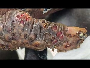 Yohana Ebole's heavy hands with jiggers #2 - full videos on riseupsociety.net & ruskenya.org