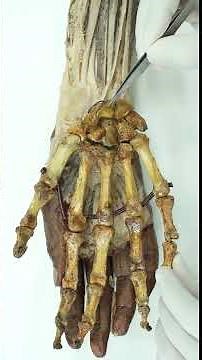 Flexor retinaculum of hand #anatomy #humananatomy #anatomyfacts #neet #neetpg