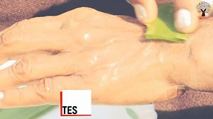 6.4K views · 109 reactions | 100 % DARK SPOT REMOVER - REMOVE PIGMENTATION, ACNE SCARS, PIMPLE MARKS, POX SCARS SPOTS | Natural Health | Facebook