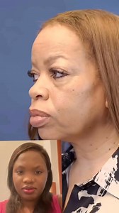 1.5K views | What a transformation! Mama went 20 years younger. Plastic Surgery can be good, the Doctor is good! Would you ever consider getting a plastic surgery? #LifestyleAndLuxury | Luxury and lifestyle | Facebook