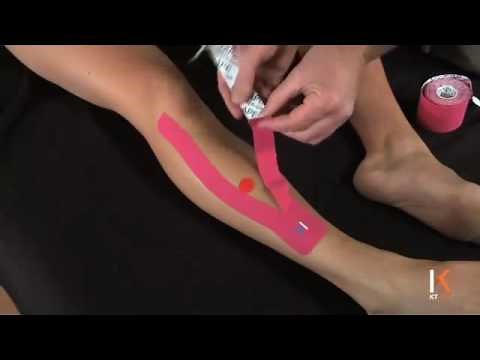 KT Tape - Kinesiology Taping Instructions for Shin Splints - Anterior