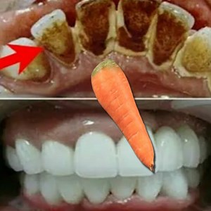 2.7K views · 136 reactions | Teeth whitening at home in 3 minutes how to naturally whiten your yellow teeth! | Our Pure Tips | Facebook