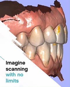 Why choose a #CarestreamDental intraoral scanner? We asked the professionals who use them: http://bit.ly/2P6lcaY. | Carestream Dental