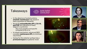 Modern Management of Filamentary Keratitis - Eyetube