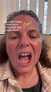 Post-anesthesia conversation after my tooth extraction and bone graft placement with Rob Anderson. For the record, she said no straws. Part 1. #outofthemouthsofbabes #anesthesia #toothextraction #bonegraft #toothfairy #oralsurgery #ouch #therewillbeblood #toothpain #nostraws #anesthesiahumor #anesthesiafunny #mrfunnyguy #hesaidshesaid #funnycouples #emptynesters #marriedlife #haha #iamtheniche #itsme #anniespeaks #wisdomteeth | Annie DeGracia Anderson