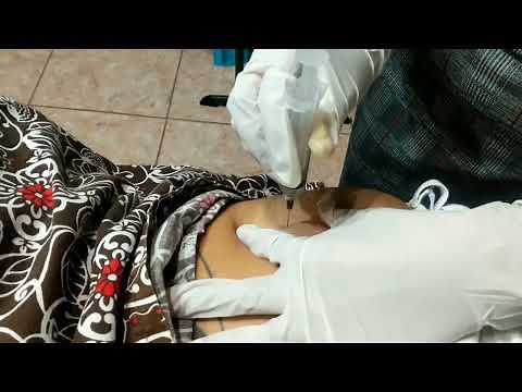 Intramuscular Injection | Gluteus 💉☑️