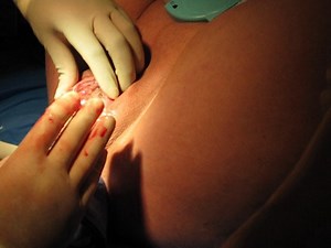 Jameson Byron's Birth