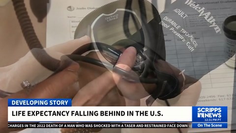 Life expectancy in the US is falling behind peer countries