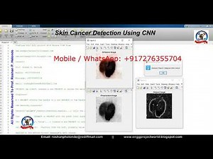 Skin Cancer Detection Using CNN | Skin Cancer Classification Using Matlab | Melanoma Detection