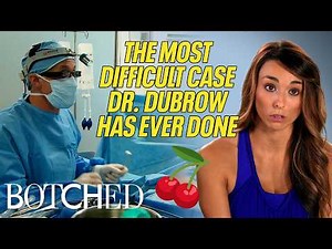 Dr. Dubrow Calls Kelsey’s Uniboob the Most Complex He’s Ever Seen (Before & After) | Botched | E!