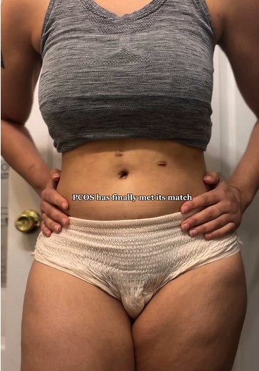 Why did nobody tell me about these sooner AND ITS A 12 PACK 😮‍💨😭 8 hours of heat for period cramps with zero drugs · ThermaCare menstrual heat wraps · period cramp relief · drug free period pain relief · wearable heat patch for cramps · fits under your clothes so nobody knows 🙌 #endometriosis #periodcramps #pcos #womanshealth #cramps @ThermaCareHeatwraps
