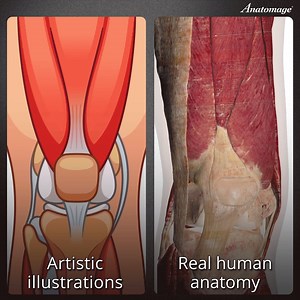 A flat image can only take you so far. With the Anatomage Table, the human knee comes to life in fully interactive 3D, built from real cadavers. Why settle for static when you can: Rotate, dissect, and explore in true 3D Visualize every ligament, tendon, and bone with clinical precision Learn from real cadaver-based models — not sketches The future of anatomy is 3D. And it’s already here with Anatomage. To learn more visit: https://anatomage.com/ #AnatomageTable #3DAnatomy #KneeAnatomy #MedicalE