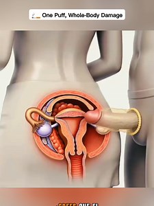 Medical 3D visualization for anatomy education.” Educational medical 3D animation For learning purposes only Non-graphic • Not real footage #medicaleducation #3danimation #anatomylearning #sciencevisuals #healthknowledge
