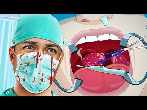 HOW TO REMOVE TONSILS (WARNING: HORRIBLE) (Tonsillitis Surgery)