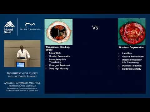 Prosthetic Valve Choice in Heart Valve Surgery
