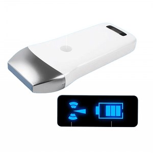 [Hot Item] Factory Direct Sale Wireless Linear Handheld Ultrasound Probe with 80 Elements Scanner