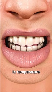 Can Hot Coffee Crack Frozen Teeth? 😨