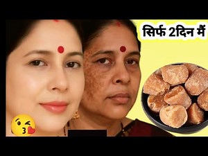 ❣️चाची की 10 साल पुरानी झाइयां सिर्फ 2 दिन में गुड़ से गई,वो गोरी भी हुई 😍