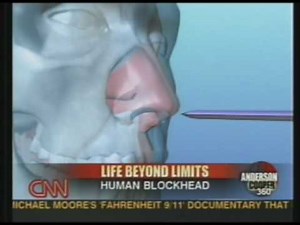 Human Blockhead Explained on CNN