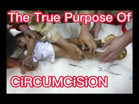 What is CiRCUMCiSiON pros, cons, benefits & definition.
