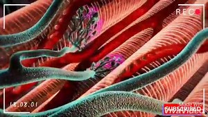 #NeonatalTetanus | Nurses Zone Documentary