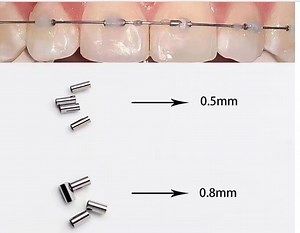 [Hot Item] Dental Orthodontic 0.5mm 0.8mm Crimpable Hooks Crimpable Mini Stops