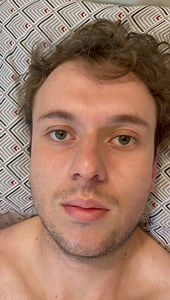 1.9K views · 32 reactions | Recuperándome, gracias al Dr. Daniel Peñafiel por este increíble cambio, les subiré y compartiré videos de mi recuperación y resultados | Paul Valdivieso EC | Facebook