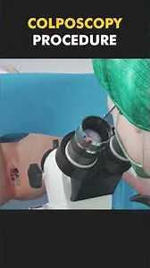 Medical World 3D Colposcopy Procedure 3D Animation #colposcopy #colposcopia #colposcopycheckup