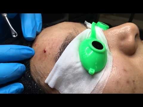 Professional Extractions Facial Lift & Pump | Blackhead Extraction | Esthetician Training Tutorial