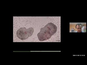 Михаил Никитин. Нейротрансмиттеры и их функции у трихоплакса - животного без нервной системы