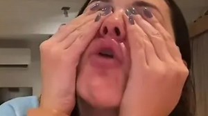 I got Botox but it was a fail - my mouth went crooked because she put too much