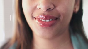 Antibiotic prophylaxis for dental procedures