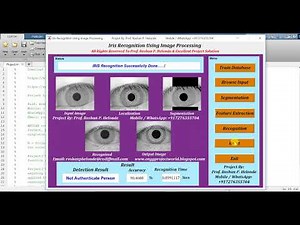 Iris Recognition Using Matlab Project | Iris Recognition Using Machine Learning Matlab Code