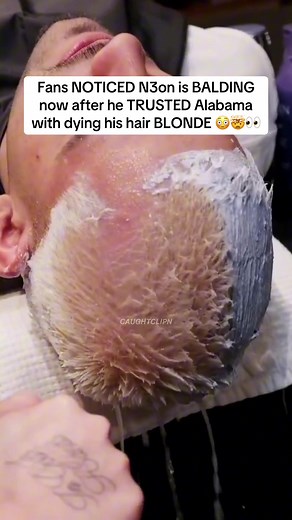 Fans NOTICED N3on is BALDING now after he TRUSTED Alabama with dying his hair BLONDE 😳🤯👀 #alabamabarker #n3on #fyp #viral