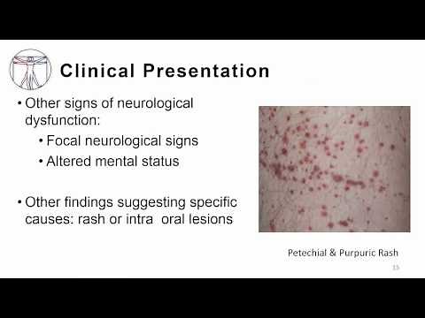 1. Overview meningitis and encephalitis