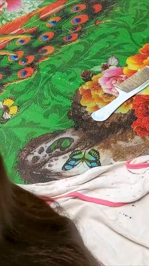 2.1K views | Getting out all of hundred lice from head | Restore Machines | Facebook