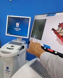 OmniBeast Touch  CAD/CAM Center Miami® #godigital #cadcamdentistry . . . #digitaldentistry #dentistry #dental #odontology #cerec #3shape #medit #sirona #3dprinting #dentsplaysirona #miami #dentaleducation #odontologia #odontologo #dentista #esteticadental #emax #veneers #ivoclarvivadent #prosthodontist #prostodoncia #odontologiadigital #cadcamdentistry #sonrisa #smiledesign #digitalsmiledesign #exocad #exocadexperts | CAD/CAM Center - Digital Dentistry | Facebook