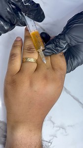 18K views · 154 reactions | You want to have baby hands  Are you battling with dry hands or hands wrinkles??? Worry less Jumella Empire got you… all you need is to book for consultation session with us 08126000002 #viralreelsシ2024 #reelsviralシ #viralreelsシ #viralreelsシ #viralpost2024 #viralpost2024 #viralvideoシ #vuralreelsvideo #Viralシ #darkknucklestreatment #skincaregoals #supplements | Stella Jumbo | Facebook