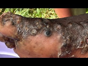 Ebusakami's Jackson so jiggered - this and 1000s other jigger videos found @riseupsociety.net